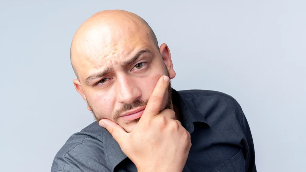 Presença Dominante - Como fazer crescer cabeço novamente