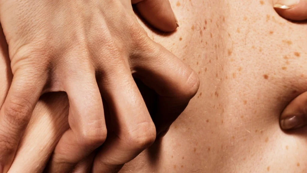 Presença Dominante - Retardantes